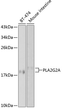 Anti-PLA2G2A Antibody (CAB1234)