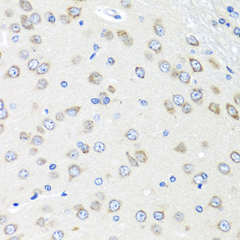 Anti-PIAS3 Antibody (CAB7060)