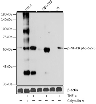 Anti-Phospho-RELA-S276 Antibody (CABP0123)