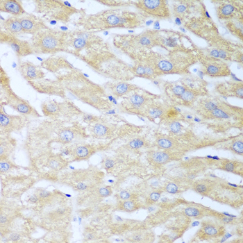 Anti-NUDT15 Polyclonal Antibody (CAB8368)