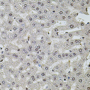 Anti-SET Antibody (CAB12502)