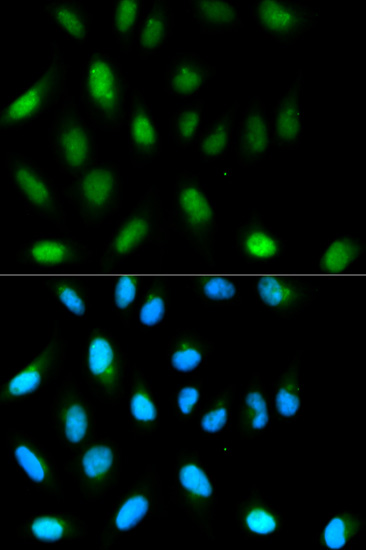 Anti-CBX5 Antibody [KO Validated] (CAB1098)