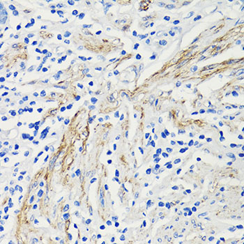 Anti-CCL4 Antibody (CAB1671)