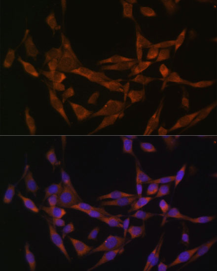 Anti-UBE2O Antibody [KO Validated] (CAB10036)