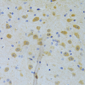 Anti-CHIA Antibody (CAB6558)