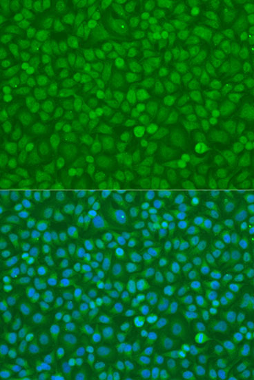 Anti-IKKAlpha Antibody (CAB0422)