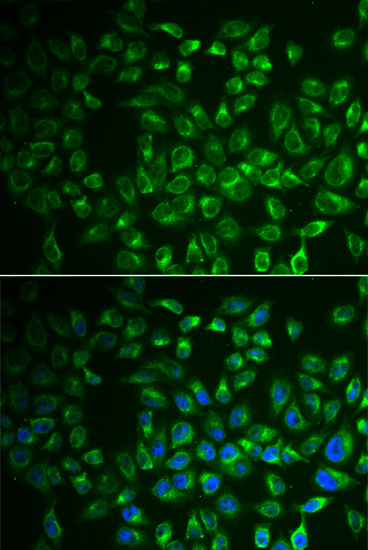 Anti-FABP6 Antibody (CAB13491)