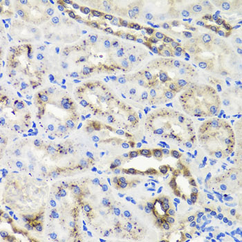 Anti-HSD11B2 Polyclonal Antibody (CAB8077)