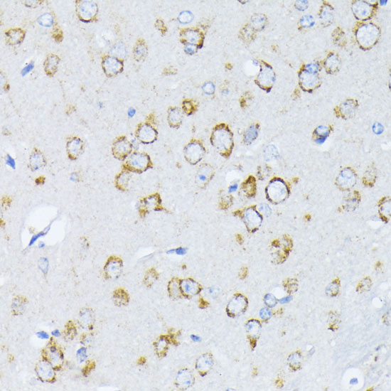 Anti-CALR Antibody (CAB1066)