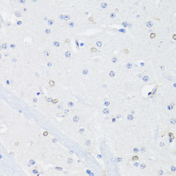 Anti-SS18L1 Polyclonal Antibody (CAB8822)