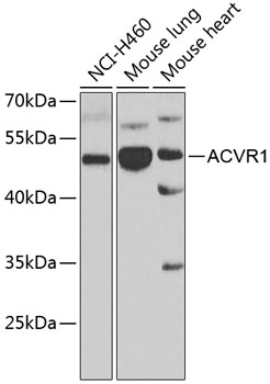 Anti-ACVR1 Antibody (CAB7542)