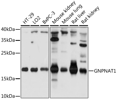 Anti-GNPNAT1 Antibody (CAB17759)