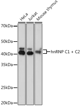 Anti-hnRNP C1 + C2 Antibody (CAB8958)