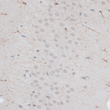 Anti-ZNF415 Antibody (CAB14913)