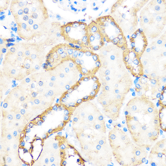 Anti-Bax Antibody (CAB15646)