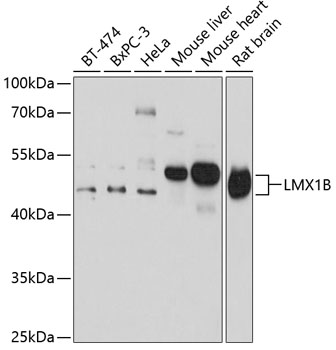 Anti-LMX1B Antibody (CAB14021)