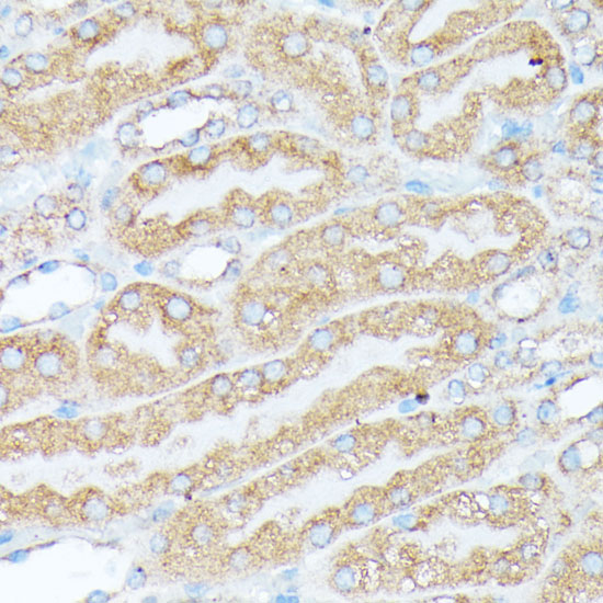 Anti-RPL7 Antibody (CAB5932)