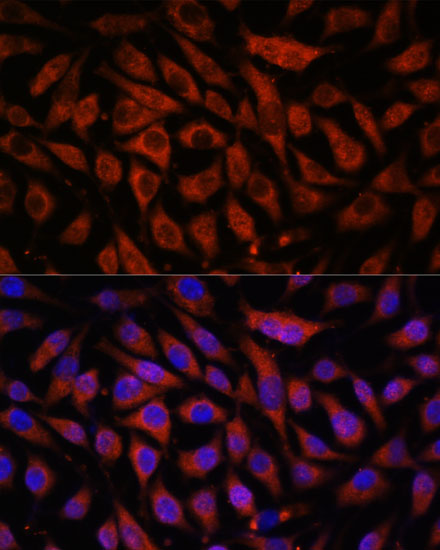 Anti-STK38L Antibody (CAB15406)