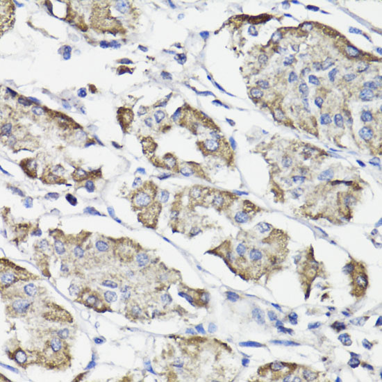 Anti-WASF3 Antibody (CAB16274)