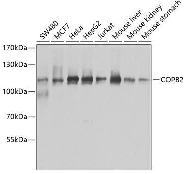 Anti-COPB2 Antibody (CAB7036)