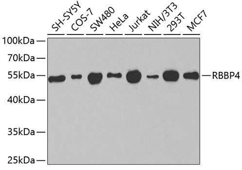 Anti-RBBP4 Antibody