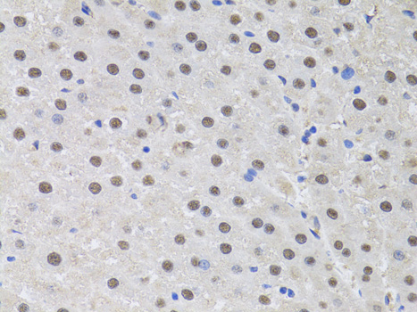 Anti-HUS1 Antibody (CAB13938)