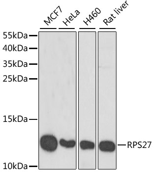 Anti-RPS27 Antibody (CAB6729)