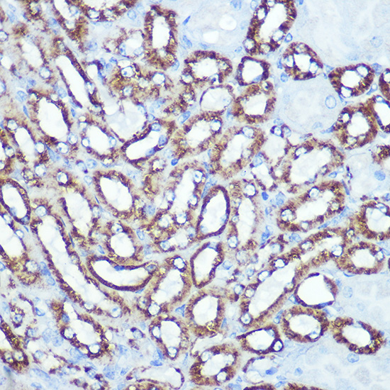 Anti-HK1[KO Validated] Antibody