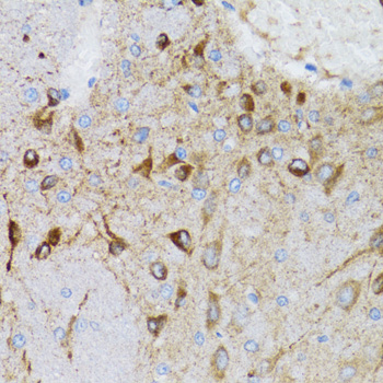 Anti-PGRMC1 Antibody (CAB5619)