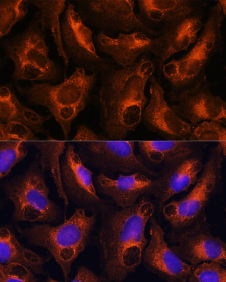 Anti-FGG Antibody (CAB5642)