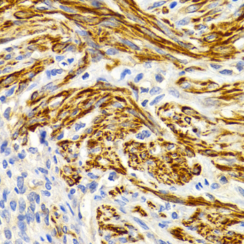 Anti-EDA Antibody (CAB2905)