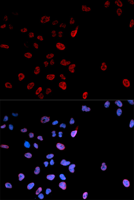 Anti-Phospho-MYC-S62 Antibody (CABP0082)