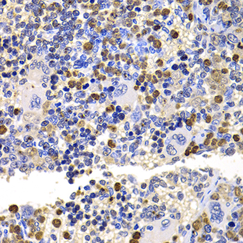 Anti-UBE2V2 Antibody (CAB6998)