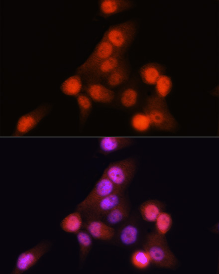 Anti-CDKN2A/p16INK4a[KO Validated] Antibody