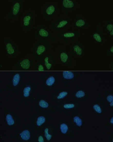 Anti-MKL1 Antibody (CAB14212)