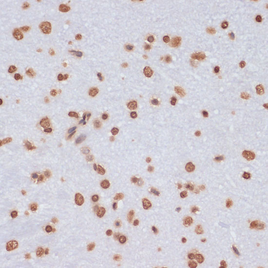 Anti-Histone H3 Antibody (CAB2348)