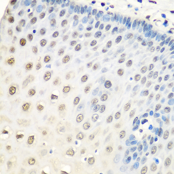 Anti-HNRNPA0 Antibody (CAB6029)