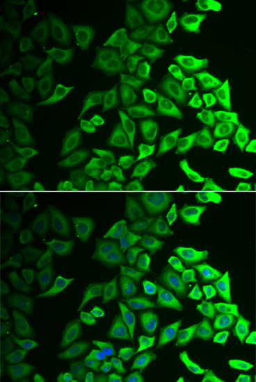 Anti-IL-18BP Antibody (CAB6445)