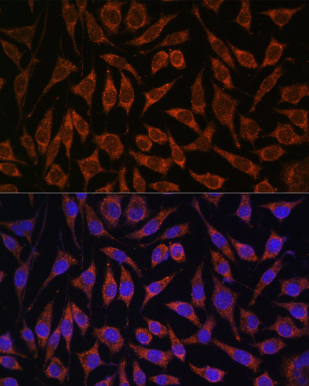 Anti-PASK Polyclonal Antibody (CAB8995)