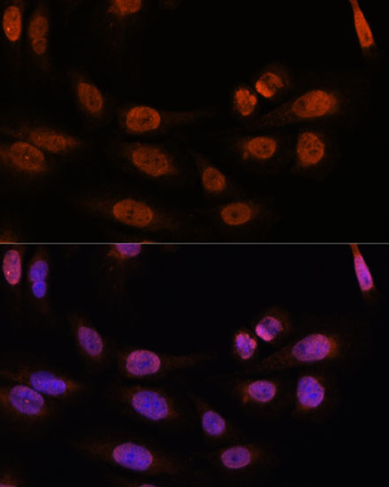 Anti-THRB Antibody (CAB1582)