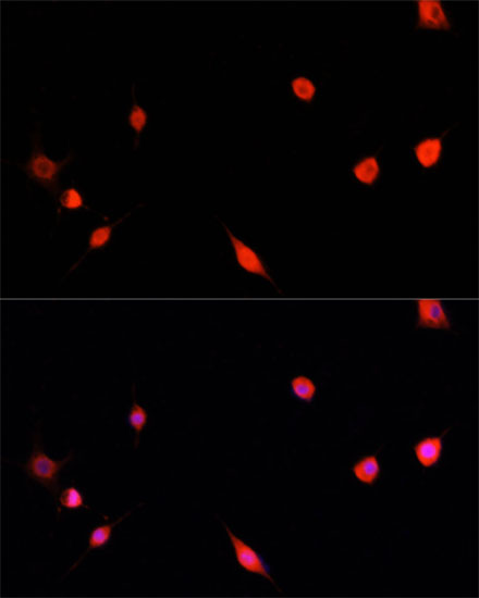 Anti-PRDM14 Antibody (CAB6502)