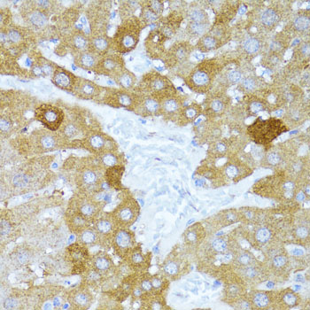 Anti-ULk1 Polyclonal Antibody (CAB8529)