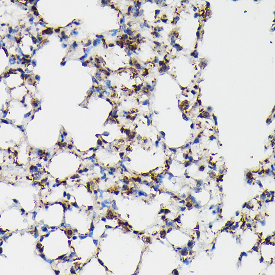 Anti-SFTPA1 Antibody (CAB3133)