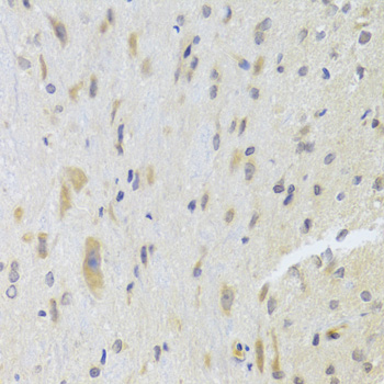 Anti-DPP3 Antibody (CAB7054)