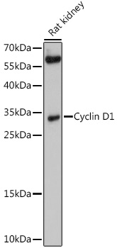 Anti-Cyclin D1 Antibody (CAB0310)