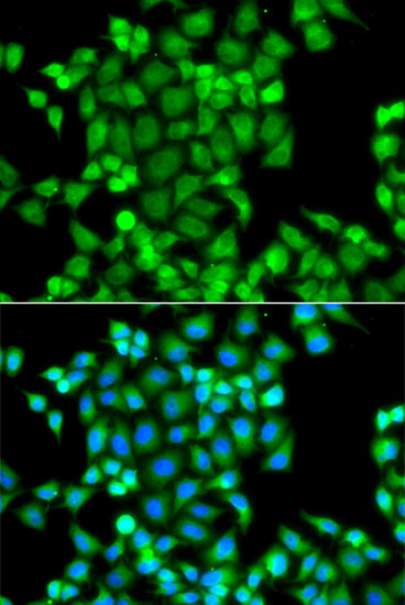 Anti-PAK2 Antibody (CAB7333)