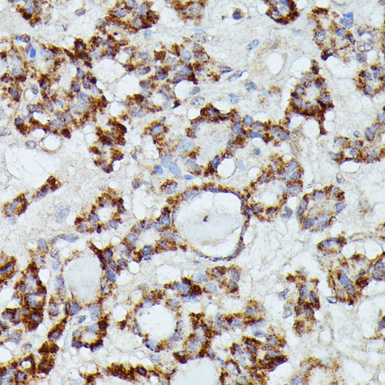 Anti-MANBA Antibody (CAB15289)