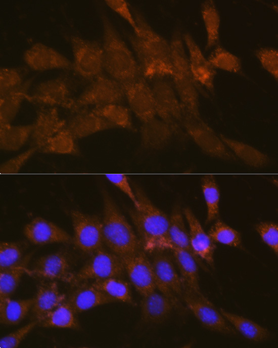 Anti-OSBP Antibody (CAB3998)