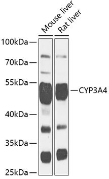 Anti-CYP3A4 Antibody [KO Validated] (CAB13484)