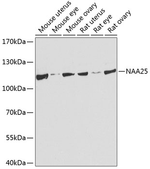 Anti-NAA25 Polyclonal Antibody (CAB8516)